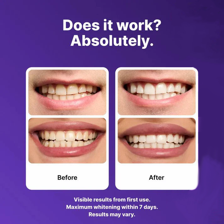 Dr.Purple™ Teeth Whitening Strips