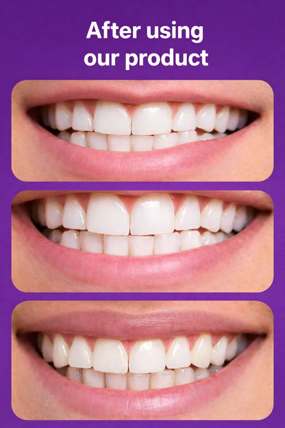 Dr.Purple™ Teeth Whitening Strips